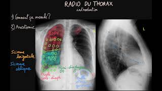 Radio du thorax  Introduction  Partie 1  Docteur Synapse [upl. by Yrdnal]