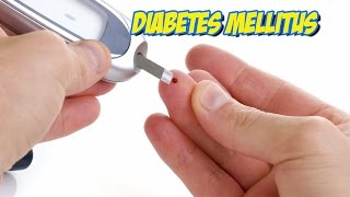 Diabetes Mellitus [upl. by Lepley150]