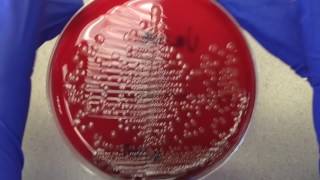 Plate Reading  Urine I [upl. by Allerbag]