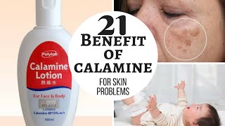 Using Calamine Lotion As Primer Matte Primer for oily skin Hack or Wack [upl. by Tod270]