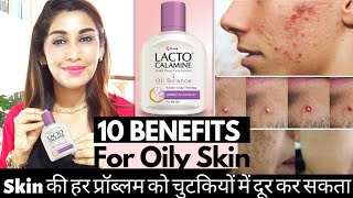 10 Uses of Lacto Calamine Lotion for Pimples Oily Skin Blackheads Acne Prone skin  Dr Menka [upl. by Namyl]