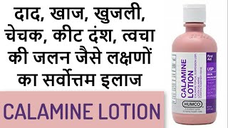 Calamine lotion  Superb remedy for mild skin infections [upl. by Aihsi765]