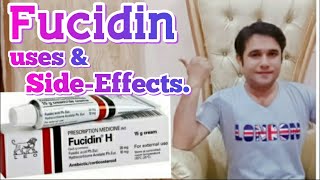 fucidin cream uses and side effects [upl. by Matilde582]