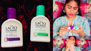 Lacto Calamine Review In தமிழ் [upl. by Lupe259]