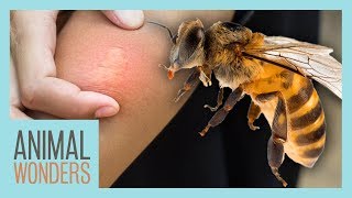 What You Need To Know About Bee Stings [upl. by Lyrem]