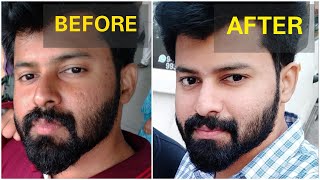 Get brighter skin Naturally in 2 Weeks  No side effects  Tamil  shadhikazeez [upl. by Novyaj]