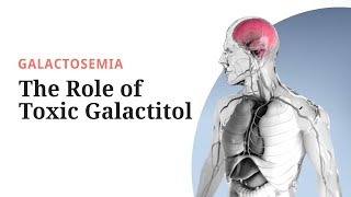 Galactosemia Pathogenesis The Role of Toxic Galactitol [upl. by Davin]