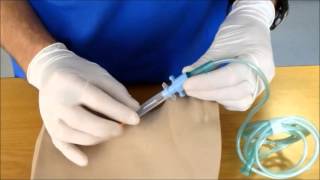 Needle Cricothyroidotomy [upl. by Subocaj]