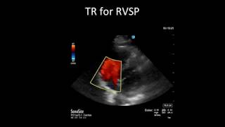 Principles of Doppler Ultrasound [upl. by Deroo253]