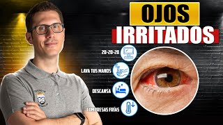 8 REMEDIOS NATURALES PARA LOS OJOS IRRITADOS [upl. by Juliet]