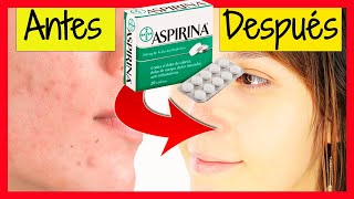 Mascarilla con ASPIRINAS 🤯BLANQUEA y QUITA ARRUGAS 😱 [upl. by Seek]