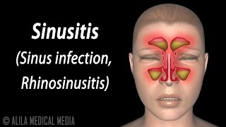 Dural Venous Sinuses [upl. by Ahsiet]